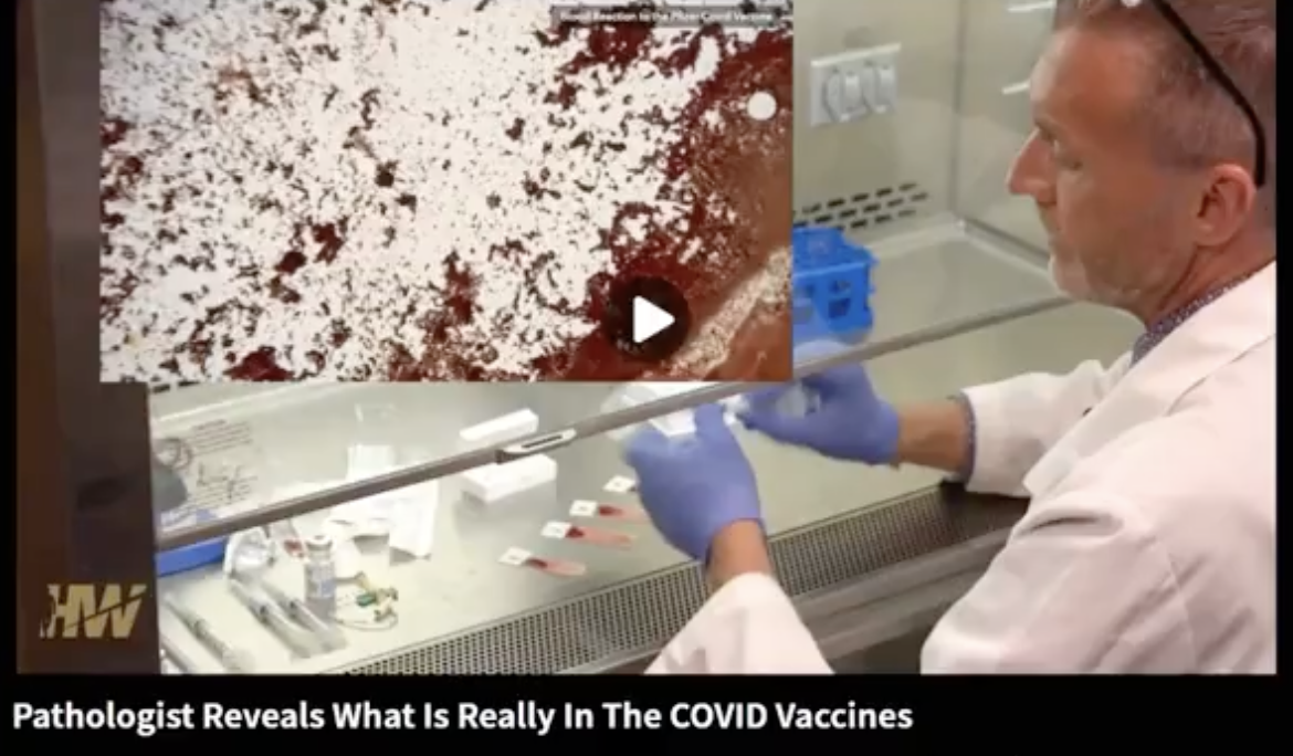 Pathologist Proves COVID Shot Causes Blood Clots in Microscope Video