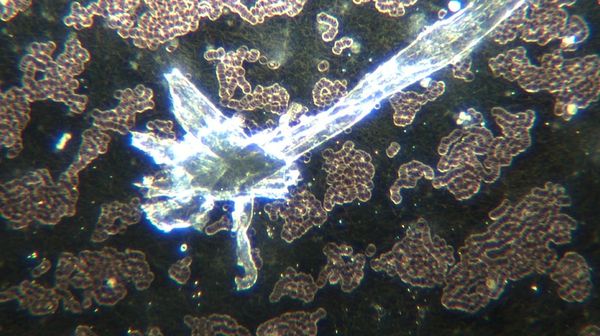 Chemical Composition Analysis Of Synthetic Biology Cross Domain Bacteria (CDB) aka Hydrogel/Graphene Filaments In Unvaccinated Blood