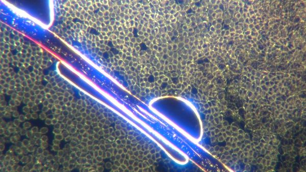 Darkfield Live Blood Analysis Of C19 uninjected Blood Showing Multicolored Filaments - How Dyes Change Functionalities of Polymer Self Assembly Nanotechnology