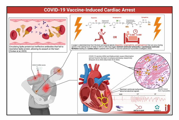 COVID-19 Vaccine-Induced Cardiac Arrest
