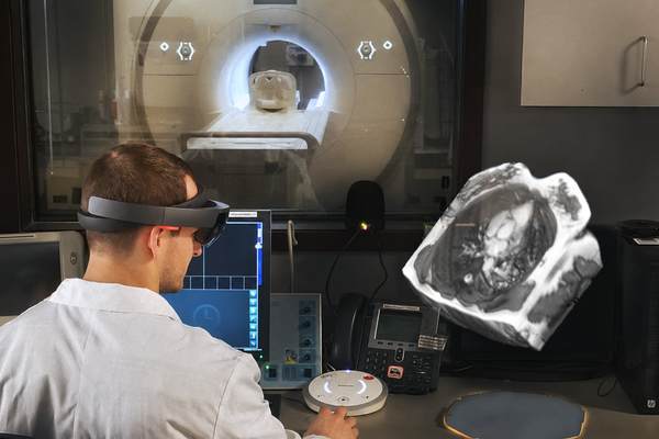 La nueva resonancia magnética holográfica